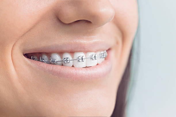 Best Invisalign and Clear Aligners  in Ada, MN